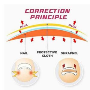 Pedicure Glue Free Toenail Patch 3pcs - Image 3